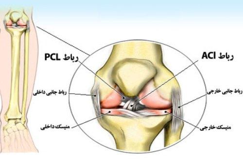  آسیب های زانو 