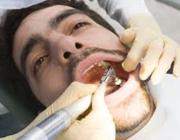  8 باور نادرست دندانی 