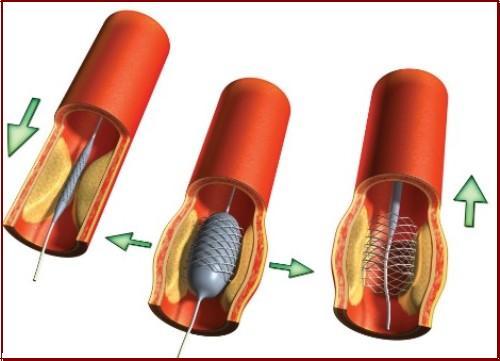 آوای زندگی