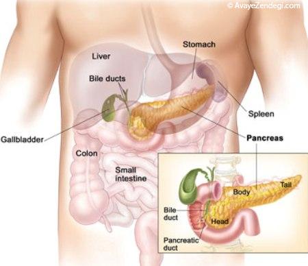 نشانه‌هایی ساده از سرطان پانکراس